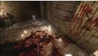 Condemned 2: Bloodshot